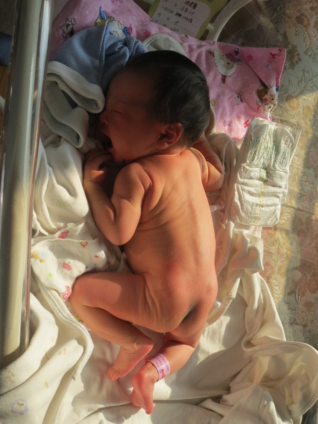 Sapphire Lin turning yellow