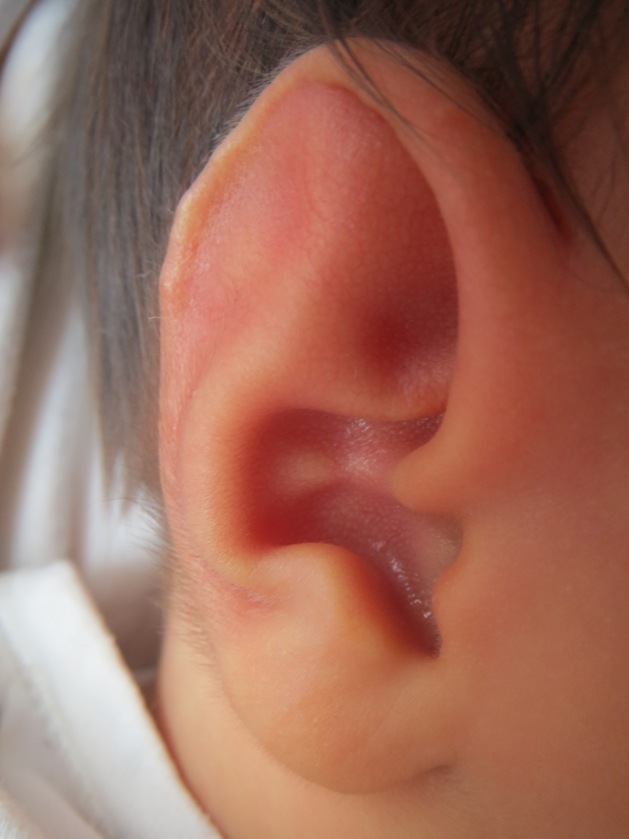 Hairy ear of Sapphire Lin.