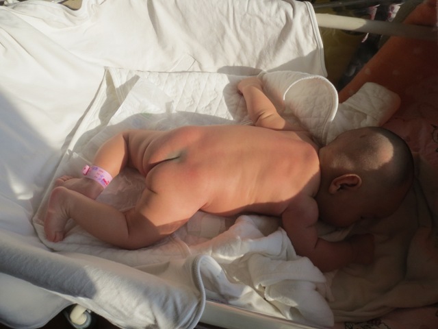 Sapphire Lin's birthmark on the head.